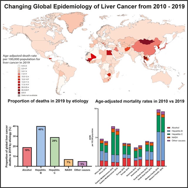 2010-2019年全球肝癌流行病學(xué)變化：NASH為肝癌最快增長(zhǎng)病因