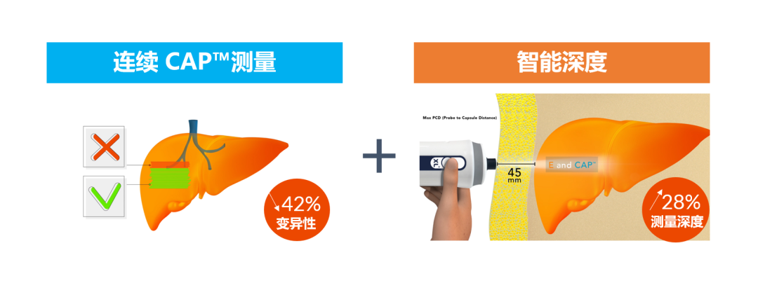 APASL2023 | SmartExam by FibroScan?在NAFLD中的應(yīng)用優(yōu)勢(shì)