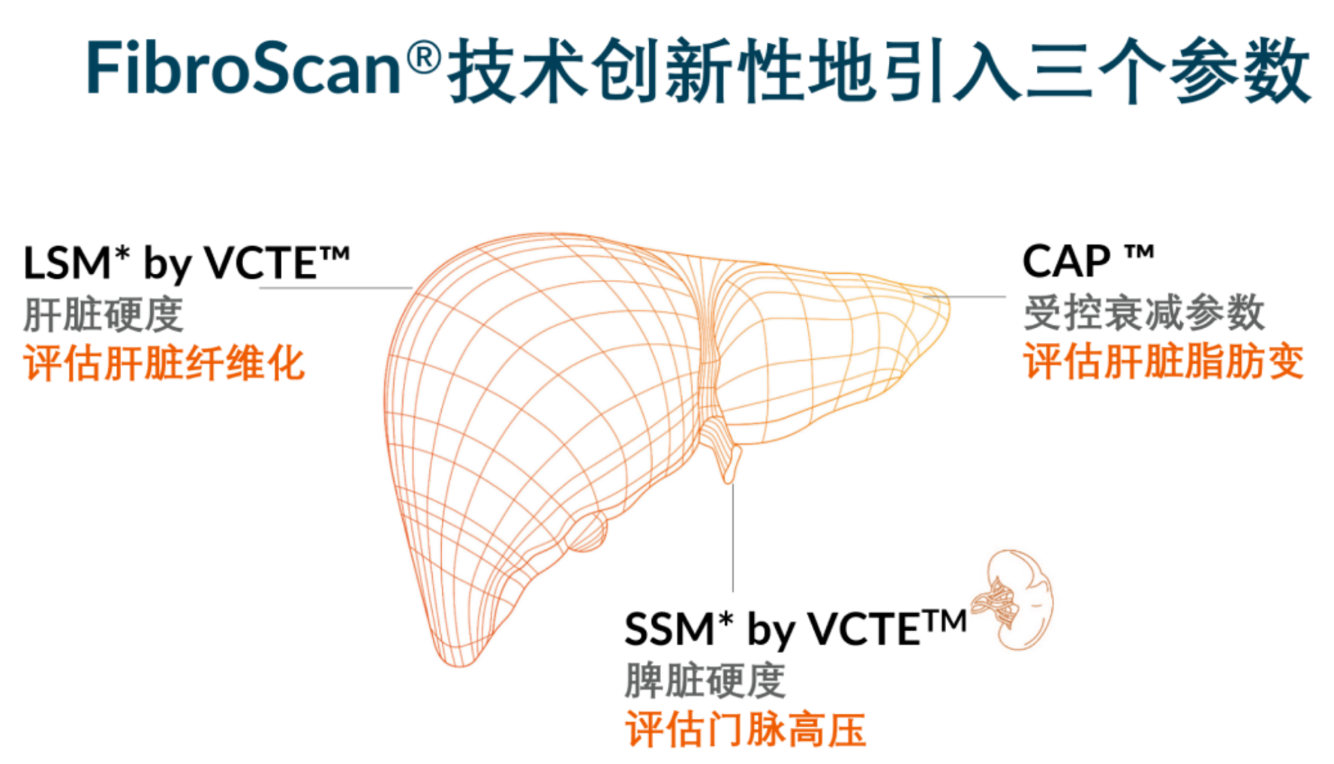 喜訊！FDA擴大了FibroScan?在肝臟綜合管理中的應用范圍