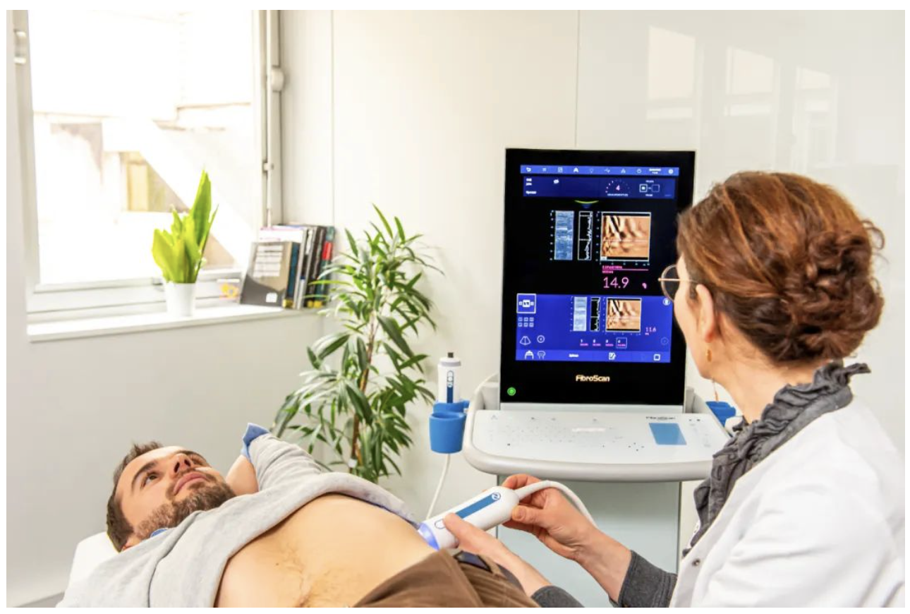 愛科森?學(xué)院專欄 | FibroScan?全球指南與共識(shí)推薦介紹（門靜脈高壓篇）