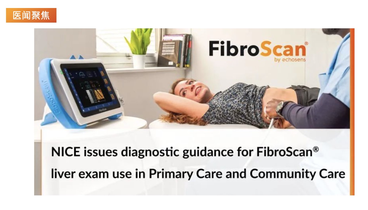 醫(yī)聞聚焦 | NICE發(fā)布具有里程碑意義的指導(dǎo)意見，將常規(guī)肝臟掃描引入初級(jí)保健機(jī)構(gòu)